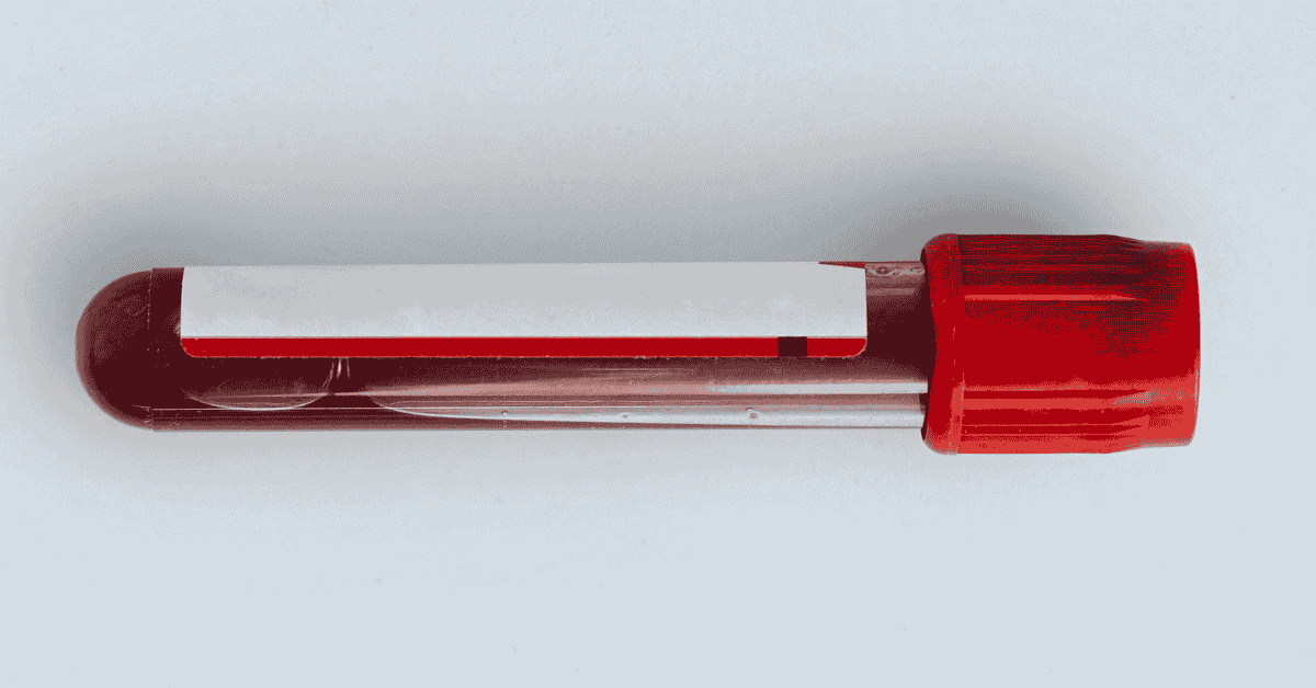 Why You Feel Fine But Your Lab Results Don’t: Understanding “Silent” Health Risks Why You Feel Fine But Your Lab Results Don’t: Understanding “Silent” Health Risks