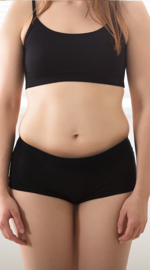 weight-loss-before-2 (1)