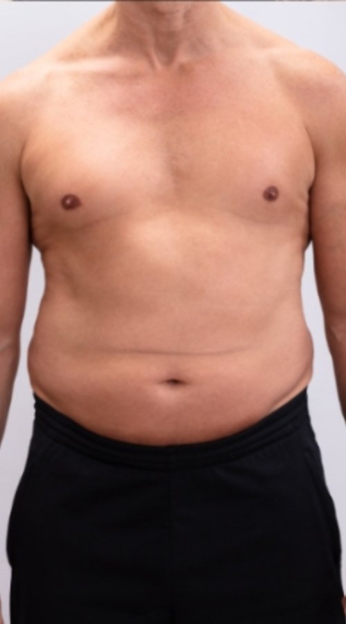 weight-loss-before-3